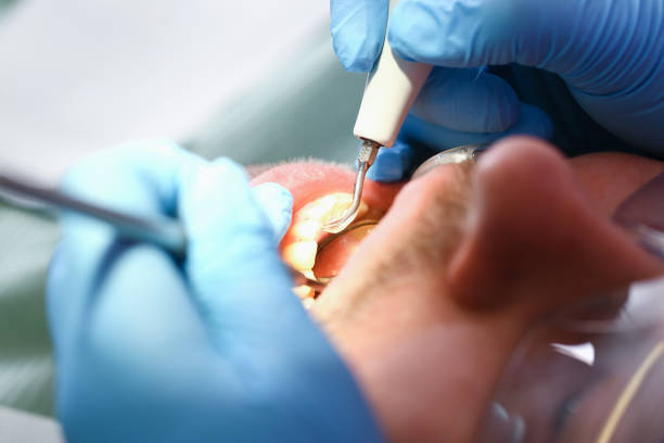 Best Root Canal Emergency Dentist  in Middlesborough, KY