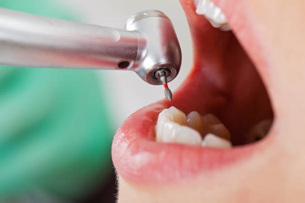 Best Knocked-Out Tooth Emergency  in Middlesborough, KY